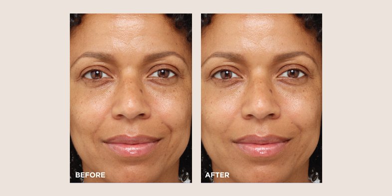 In Article Moisturizer By Skin Type WaterCream 1